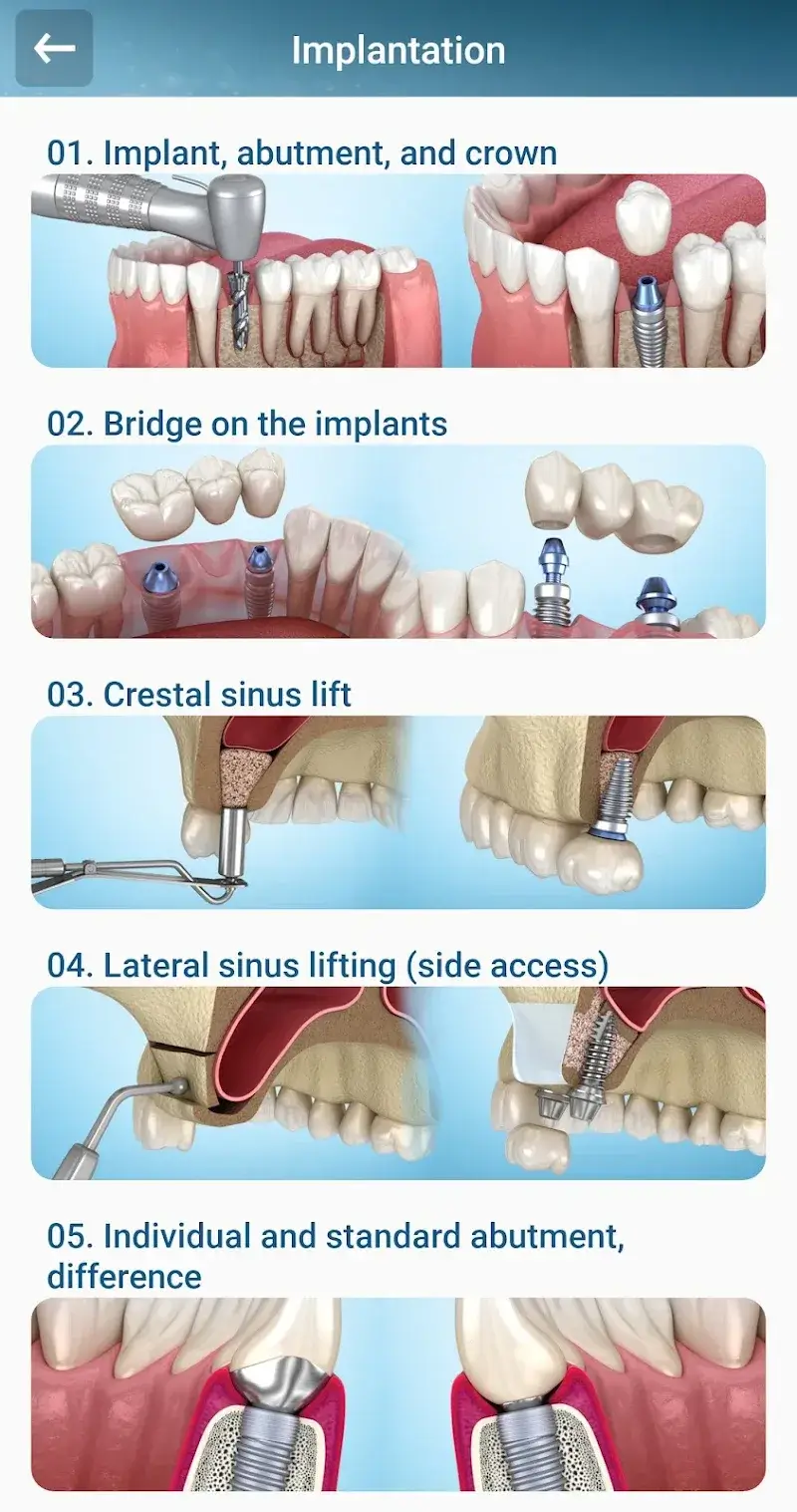 Dental 3D Illustrations screenshot 3