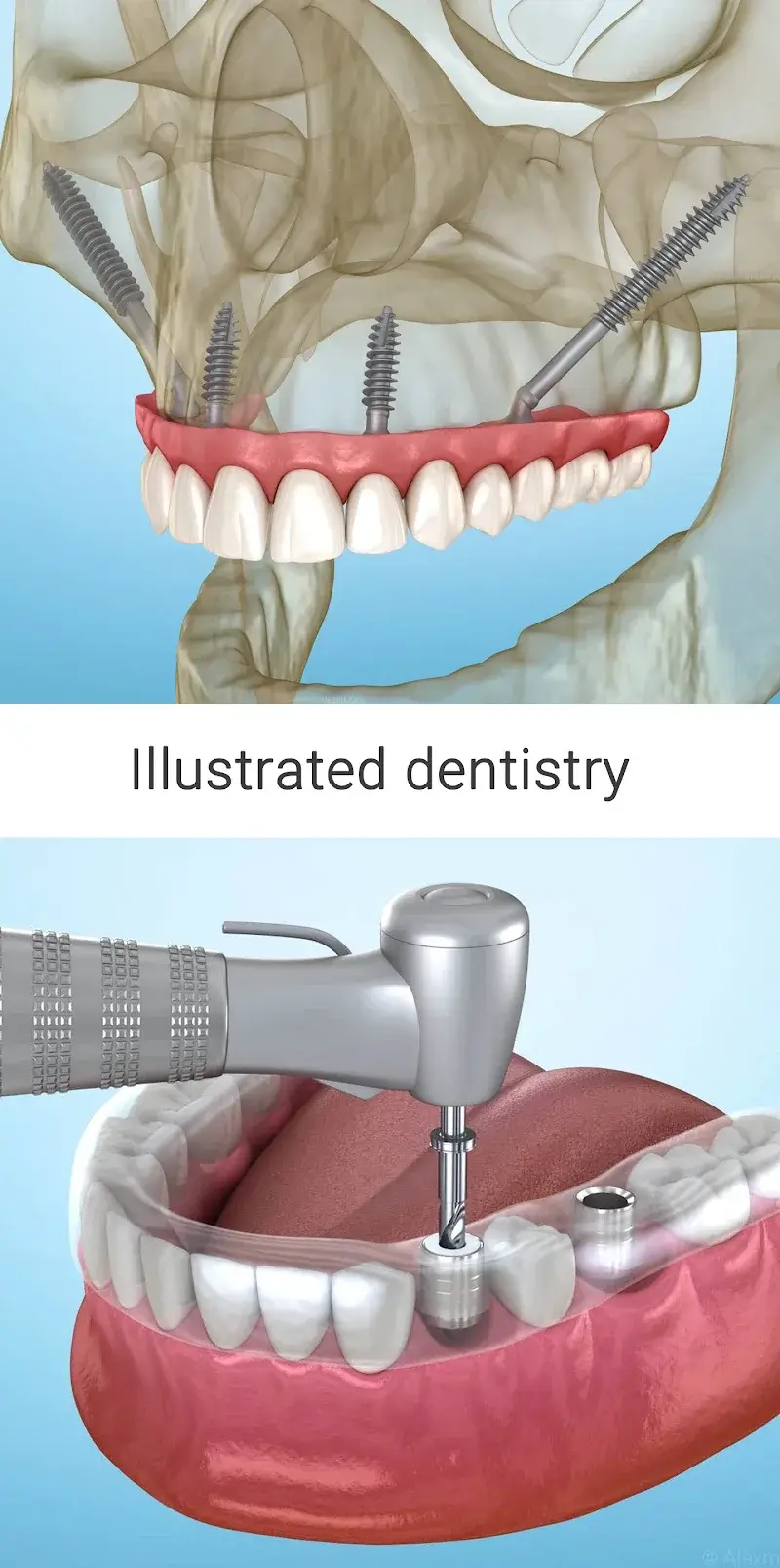 Dental 3D Illustrations screenshot 6